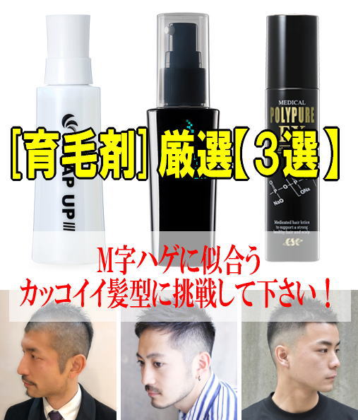 M字ハゲにいい育毛剤の条件と選び方&5つの選定基準で厳選した育毛剤【3選】がコレ!
